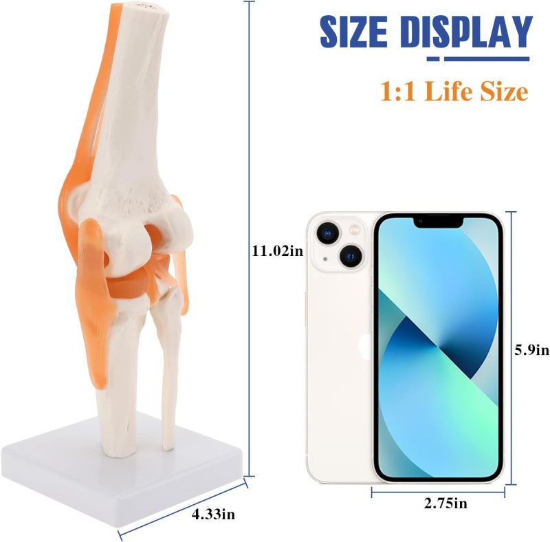 Human Knee Joint Model with Functional Ligaments