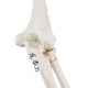 Life-Size Human Arm Skeleton with Clavicle, Scapula, and Articulated Hand Anatomy Model