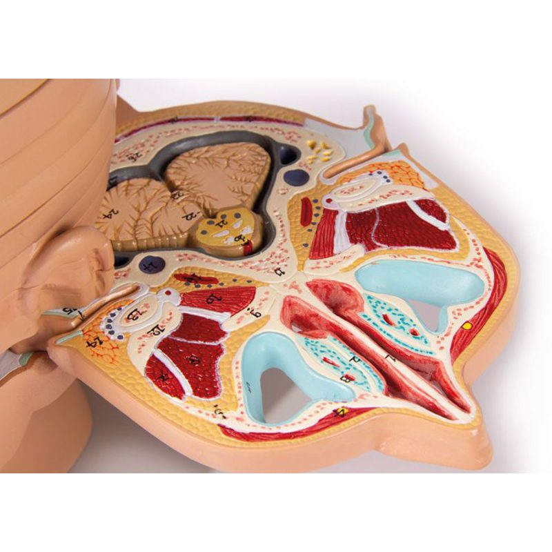 Disc Head Anatomical Model, Life Size, 12 Layers