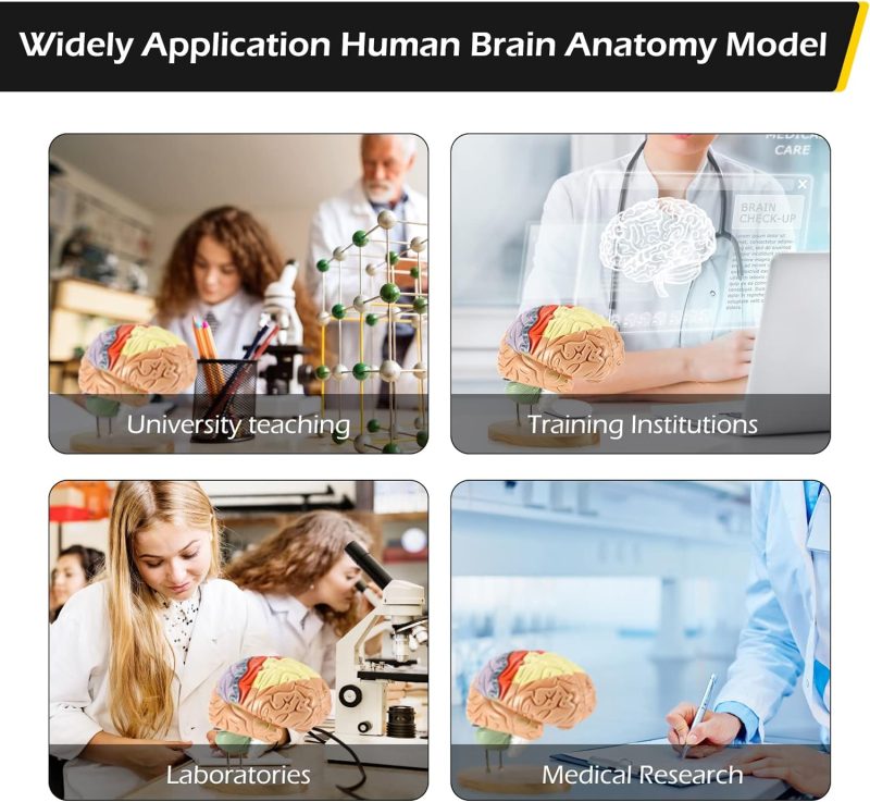 Human Brain Anatomy Model 2X Life Size