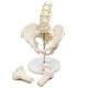Male Pelvis with Femur Heads and Lumbar Vertebrae
