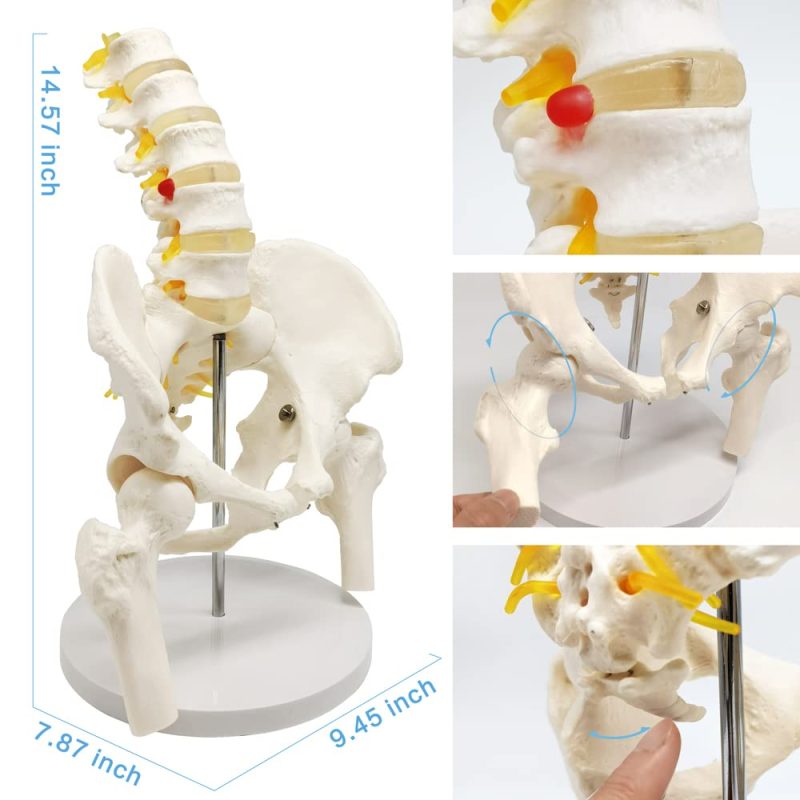 Male Pelvis with Femur Heads and Lumbar Vertebrae