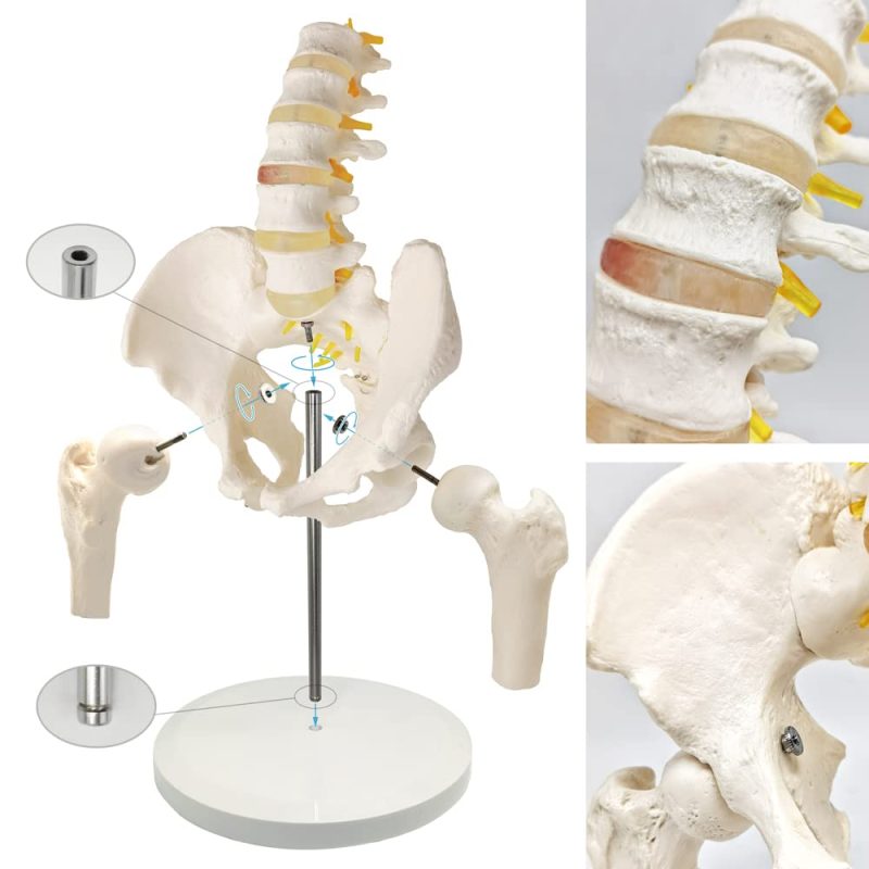Male Pelvis with Femur Heads and Lumbar Vertebrae