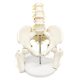 Male Pelvis with Femur Heads and Lumbar Vertebrae