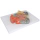 Enlarged Nasal Cavity Anatomy Model 3-Part