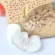 Enlarged Nasal Cavity Anatomy Model 3-Part