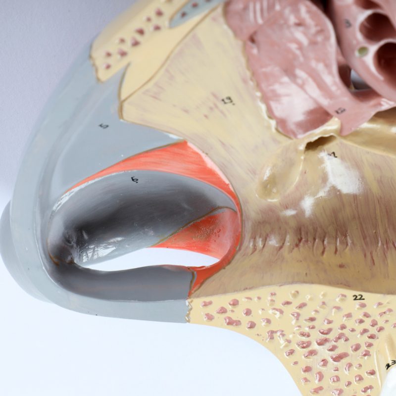 Enlarged Nasal Cavity Anatomy Model 3-Part