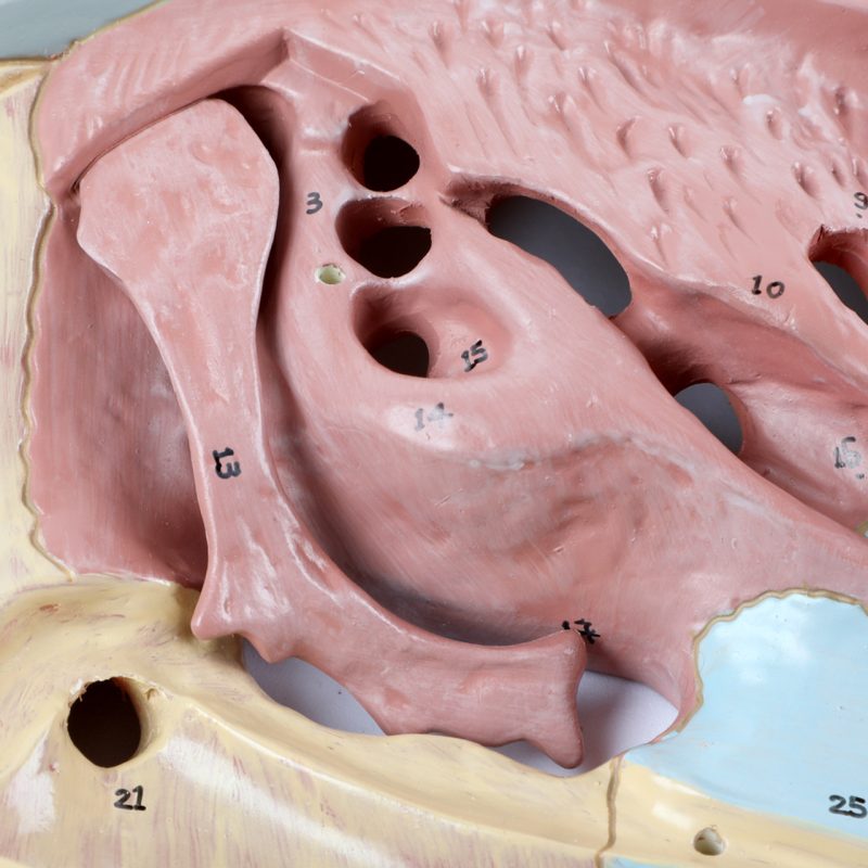 Enlarged Nasal Cavity Anatomy Model 3-Part